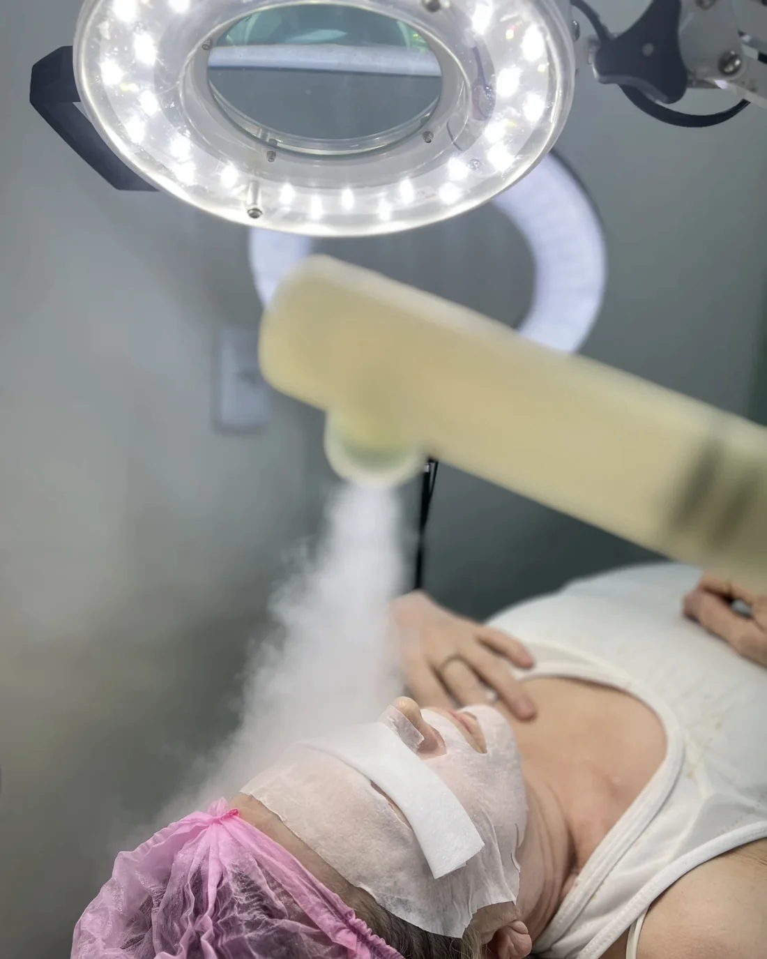 Paciente deitada na maca, de touca e com os olhos protegidos, recebe vapor no rosto sob a lupa de LED acesa